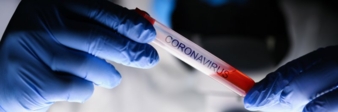Coronavirus-Corona-Virus.jpeg